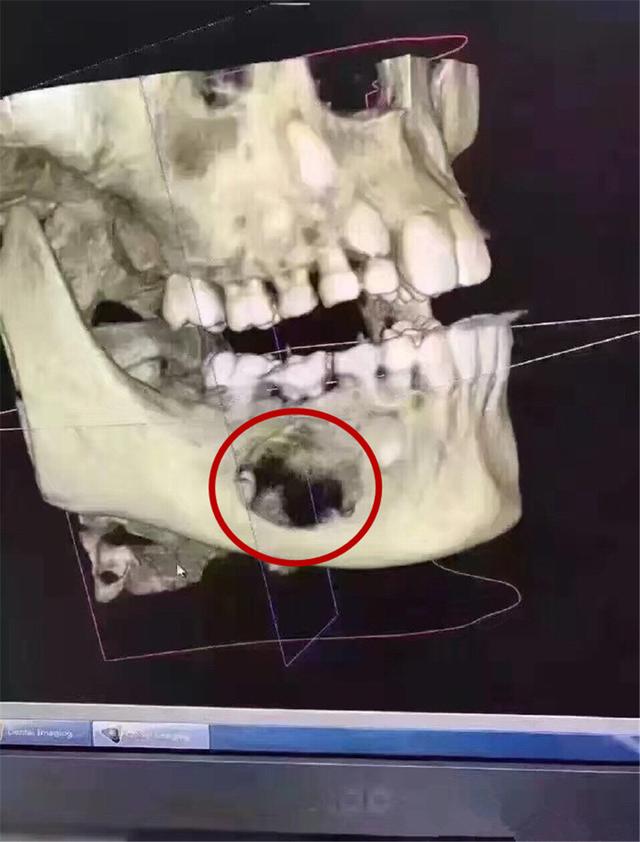 儿童x光牙片图2