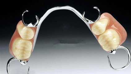 活动假牙一般有几种,比如说钢托的,还有隐形义齿等,适合单牙,多牙
