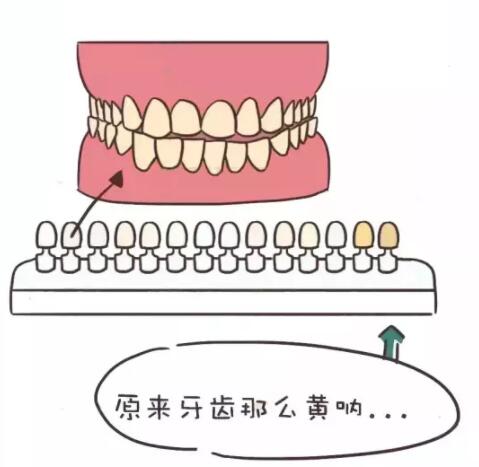 牙齿多久时间可以美白