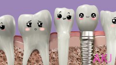 做了种植牙后 还可以做正畸矫正牙齿吗？