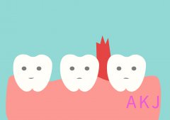 牙龈出血如何处理？
