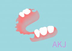 活动义齿和固定义齿哪个好？