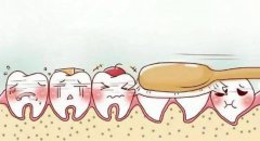 深圳牙医提醒：避免横向刷牙造成楔状缺损