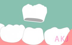 久用烤瓷牙容易引起什么牙齿疾病？