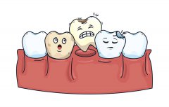 爱康健口腔牙周科：牙齿松动、咀嚼无力是怎么回事？