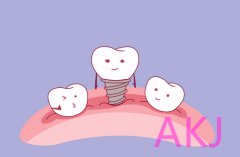 爱康健口腔|种植牙术后口腔检查和维护的必要性